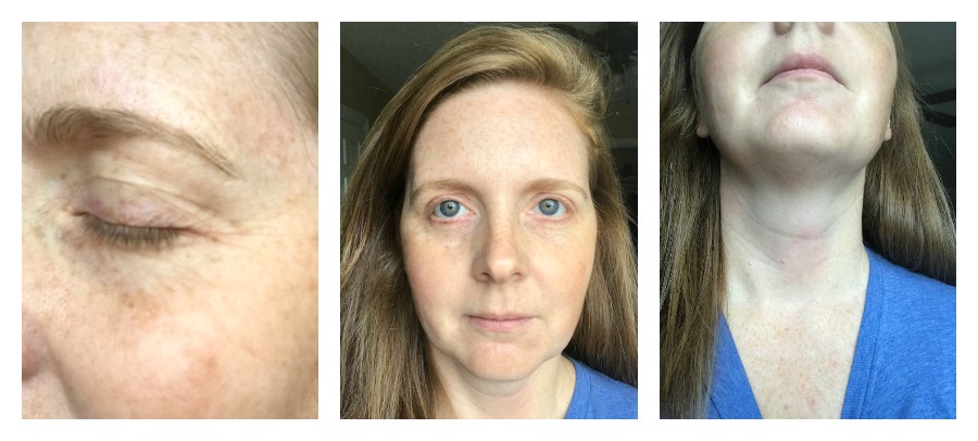 Does bakuchiol really work? We tried it. | Before photos | ©️ Kate Etue for Cool Mom Picks